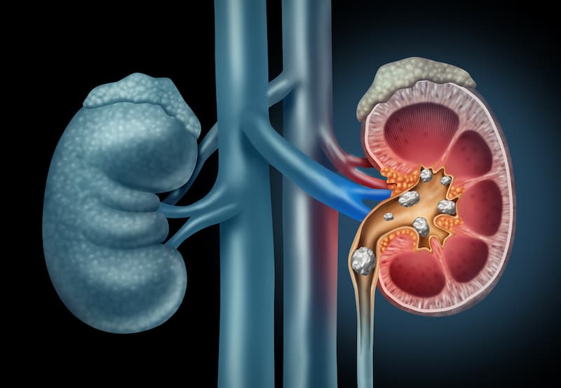 Flank Pain torment is torment in one side of the body between the upper  tummy range (midriff) and the back.