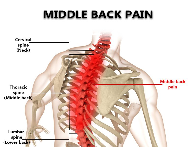 Mid Back Pain Treatment NYC