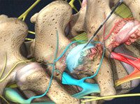 Facet Joint Injection Thoracic Spine