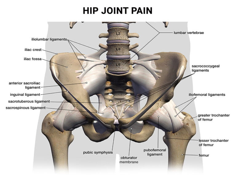 Is Hip Pain The Same as Herniated Disc Pain?