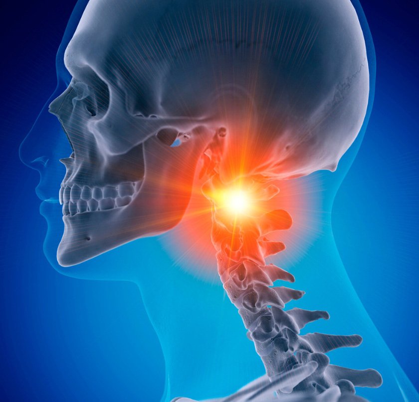 Neck Pain Specialists in NYC