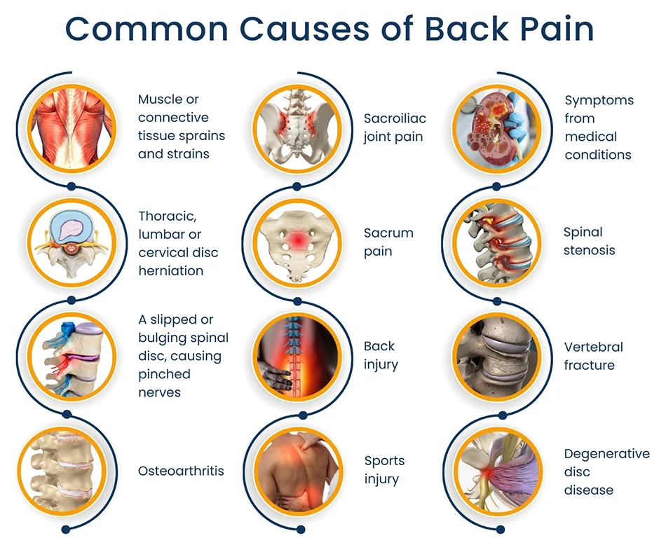 Common Causes of Back Pain