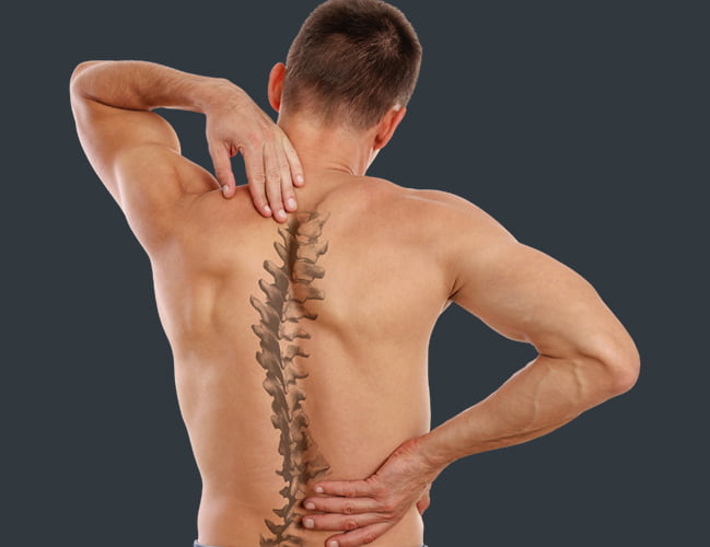Scoliosis