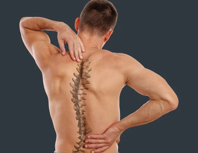 Scoliosis