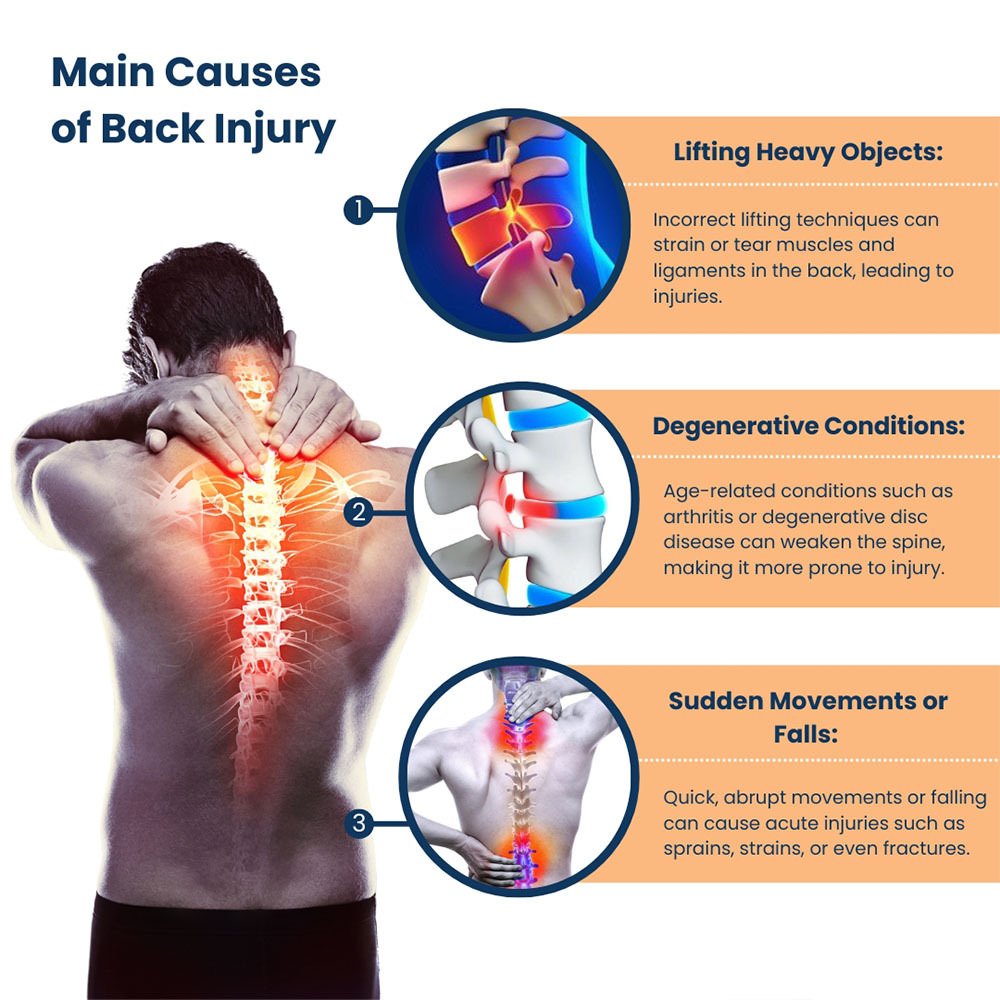 Main Causes of Back Injury