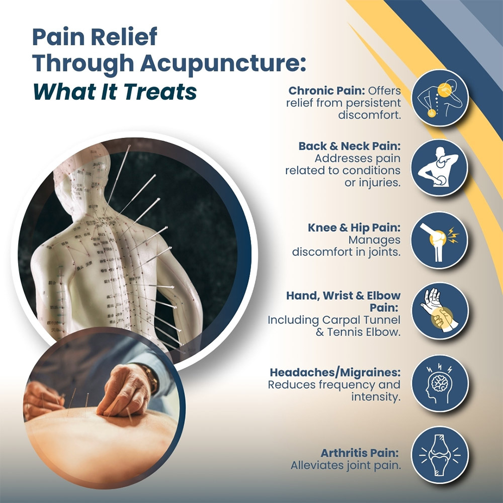 Pain Relief Through Acupuncture