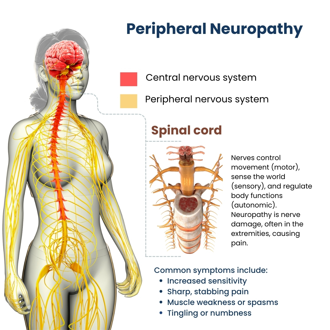 Peripheral Neuropathy