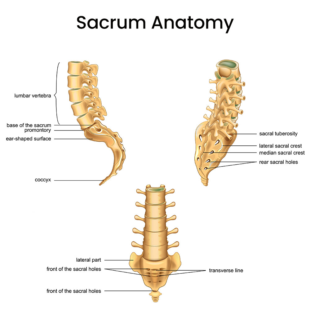 Sacrum Pain Treatment in NYC