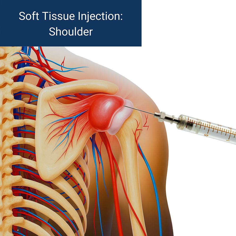 Soft Tissue Injection Shoulder New City, NY